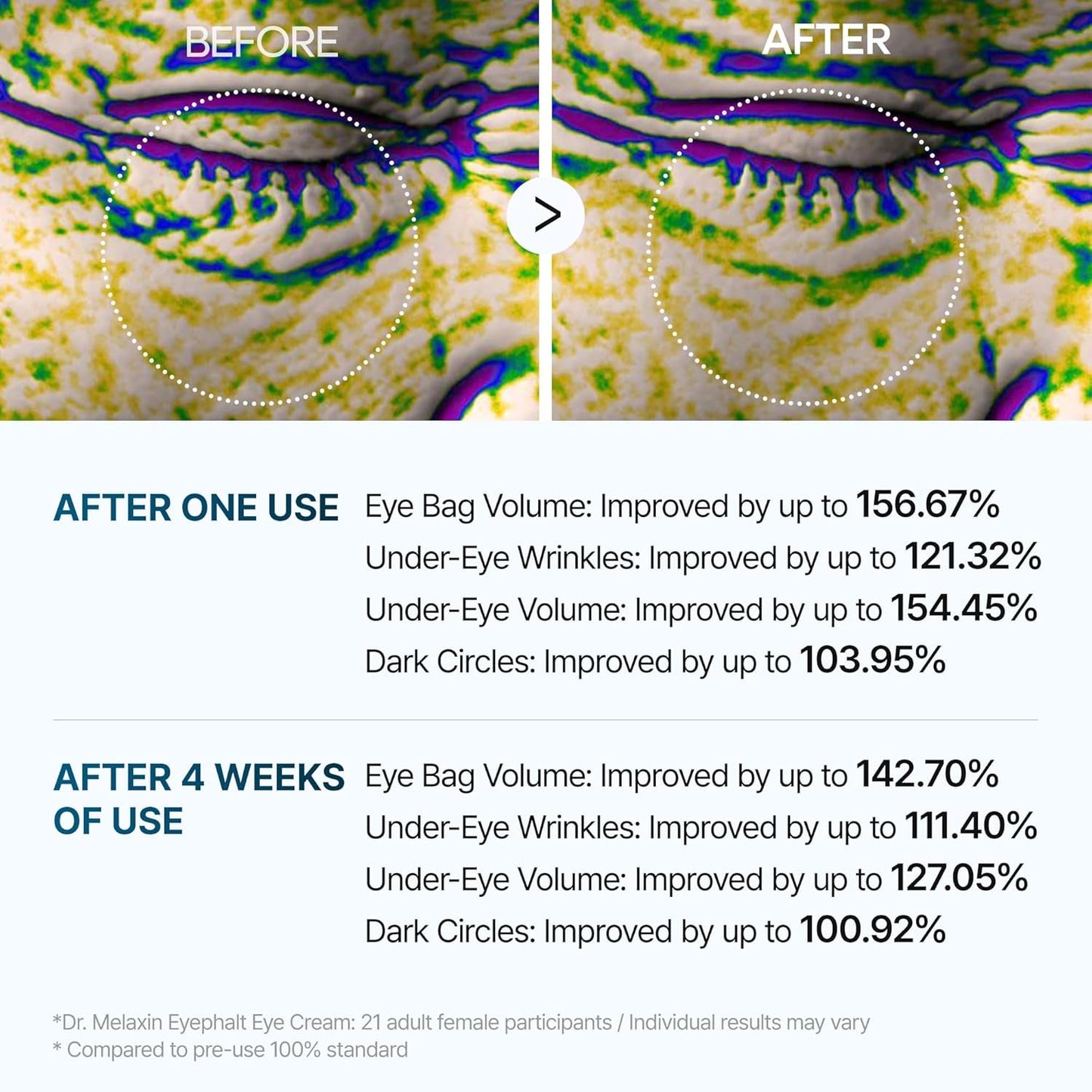 Eyephalt Miracle Repair Cream – EGF-Infused Under Eye Savior (0.33 Fl.Oz)